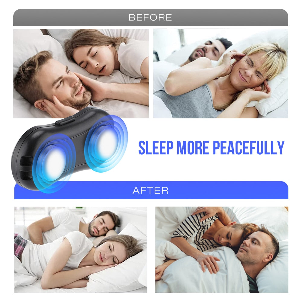 What Is The Best Anti Snoring Device