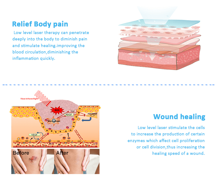 What Is Lllt Therapy