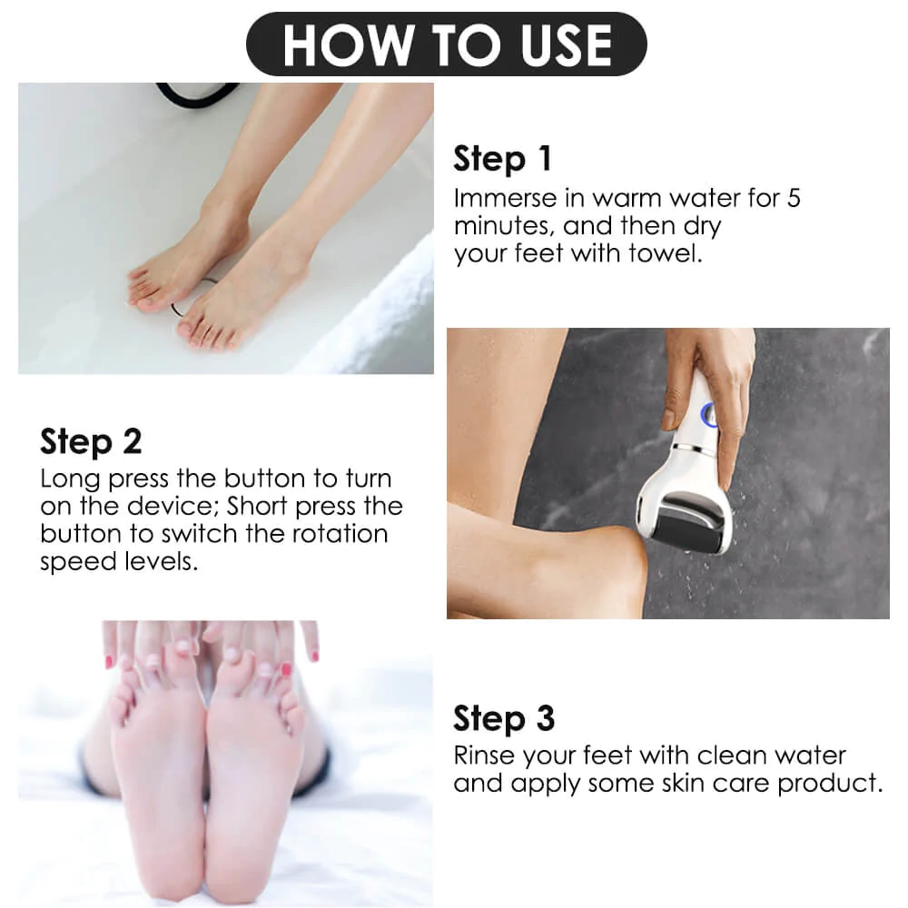 How To Remove Calluses From Feet At Home