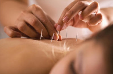 Back Pain Acupuncture - Your Back Pain Relief 