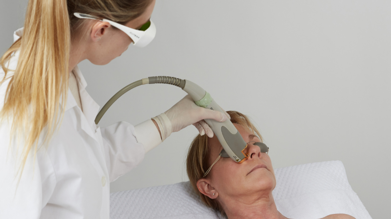 Laser Genesis Procedure