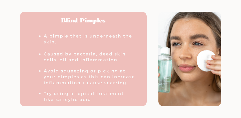 blind pimples