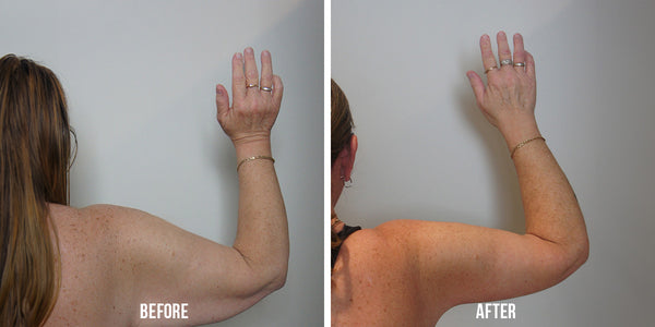 QI LITE™ Red Light Therapy Panel Arms Result