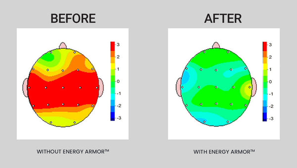 Energy Armor™ Protect Your Brain: Check Out My Brain Scans