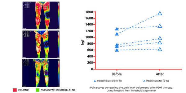 pemf-therapy-graph