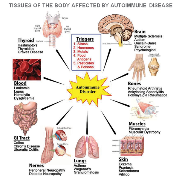 Autoimmune Chart