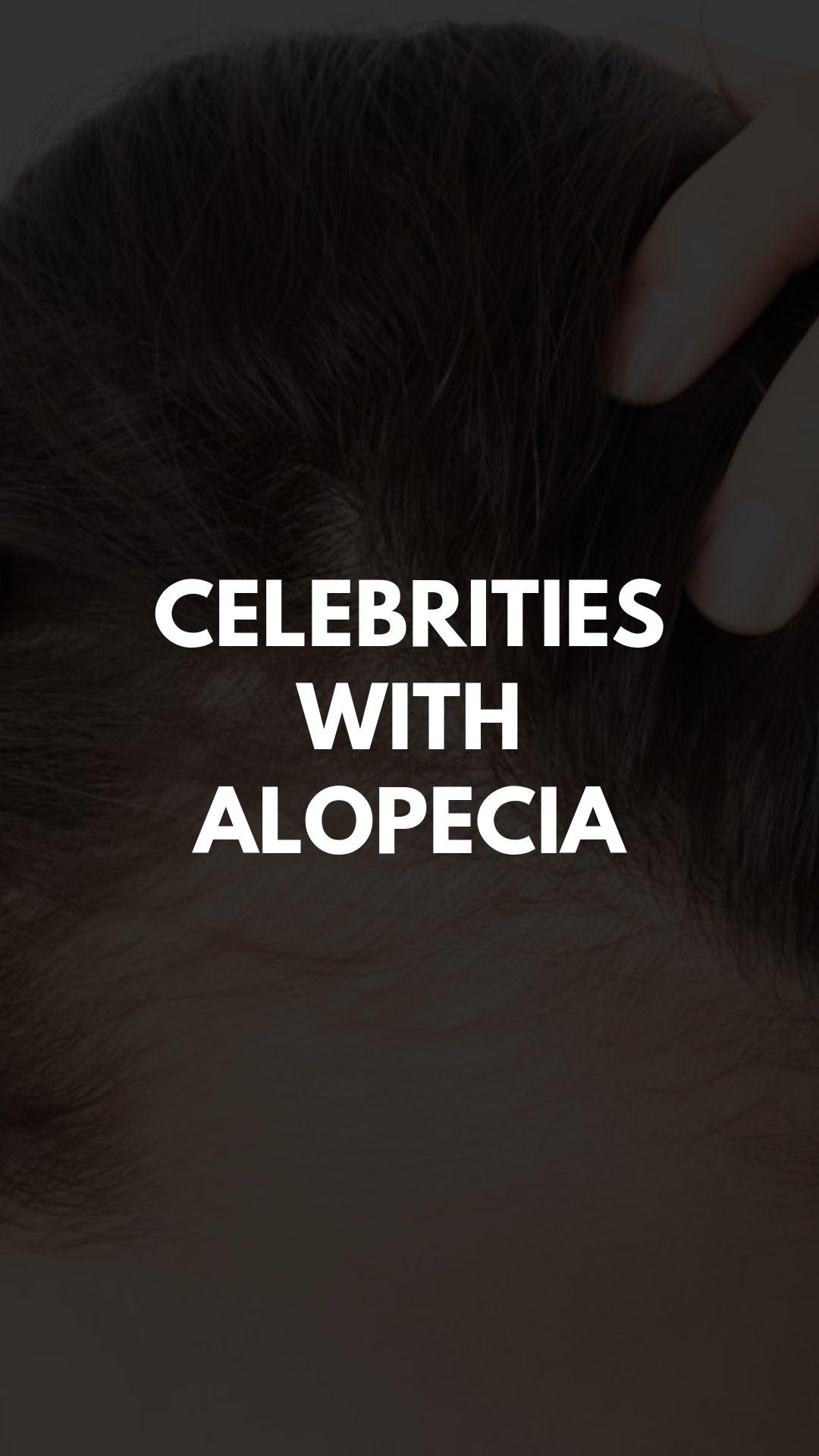 Celebrities with Alopecia