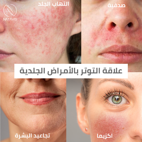 skin diseases