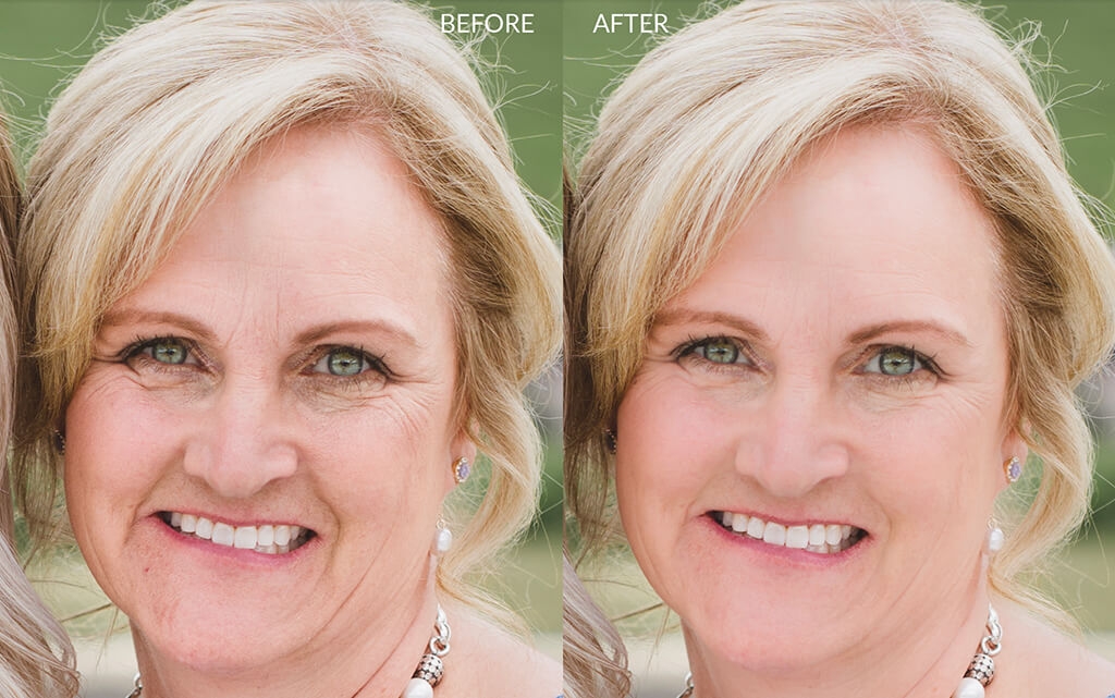 How to Remove Wrinkles in Lightroom