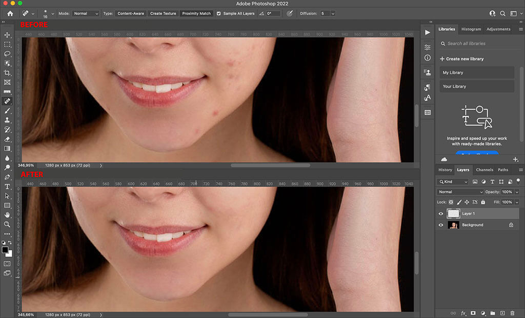 How to cover up a pimple in Photoshop