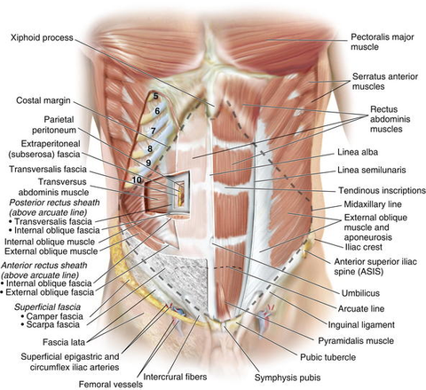 transversalis fascia hernia