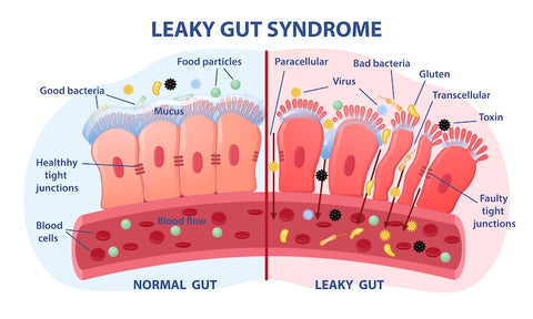 diagram showing healthy gut versus leaky gut
