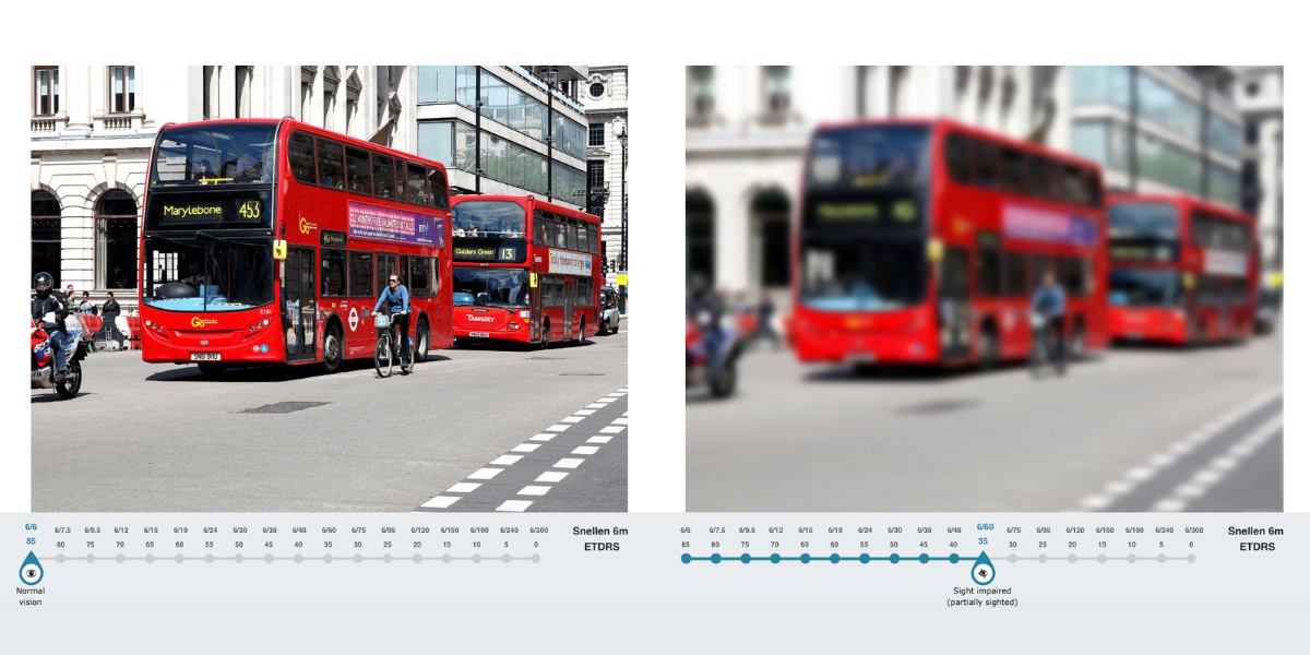 Two images of a bus with sliders underneath. The first is in high definition and the slider is set to normal vision. The other image is blurry and the slider is set to Sight Impaired