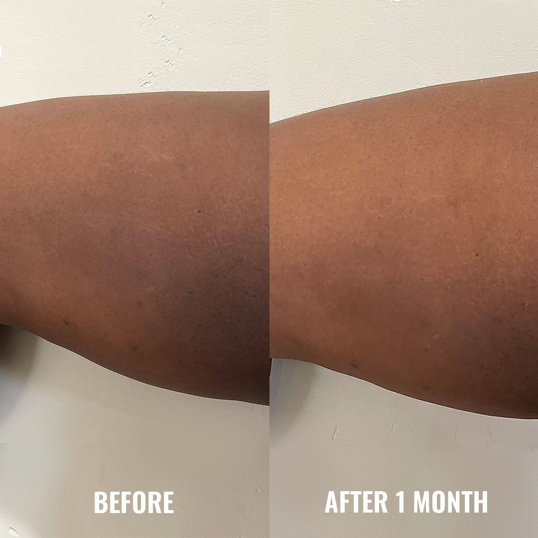 Discoloration Correcting Body Treatment