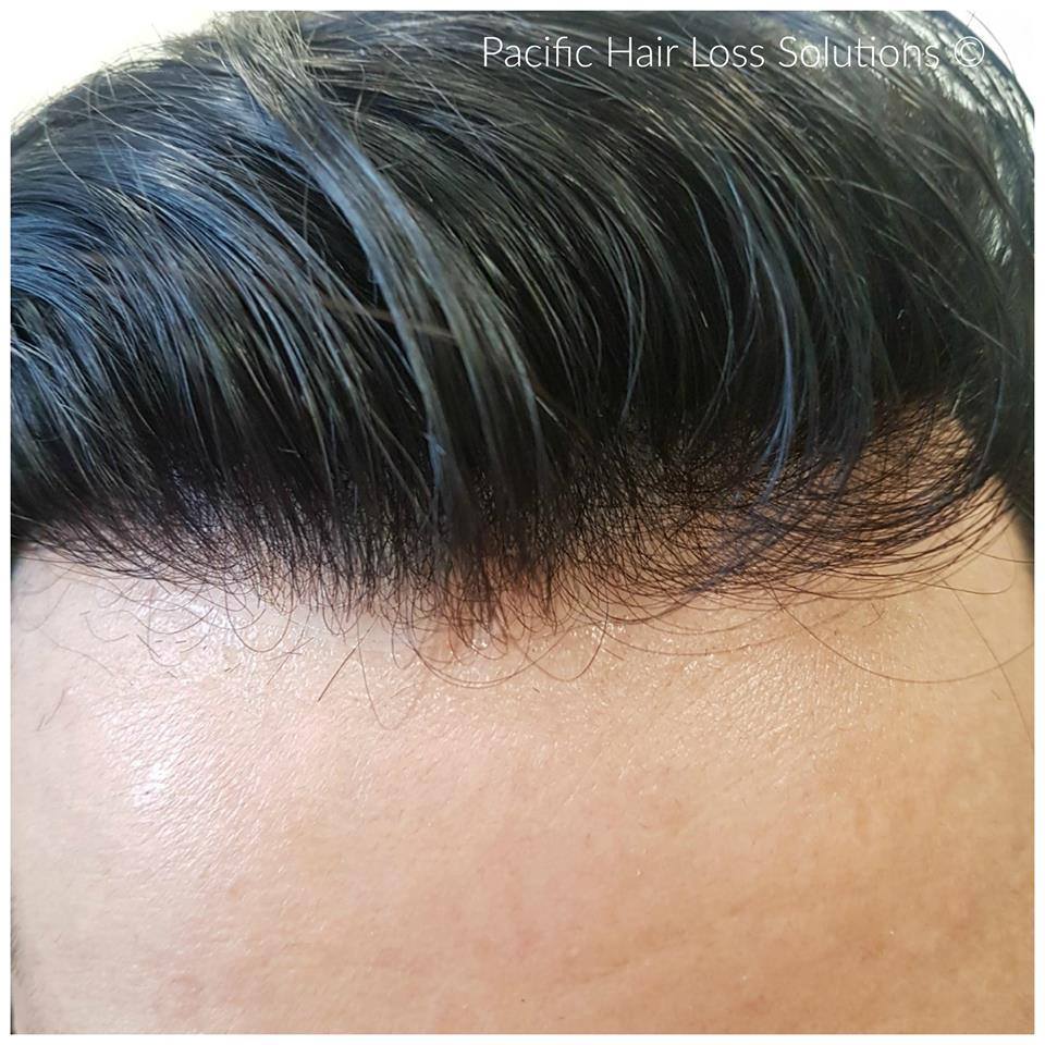 Men's hairpieces injected with Remy human hair (0.03mm base thickness