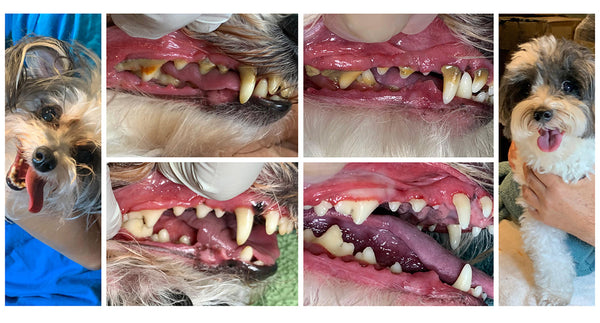 Dental Cleaning Before and After Images