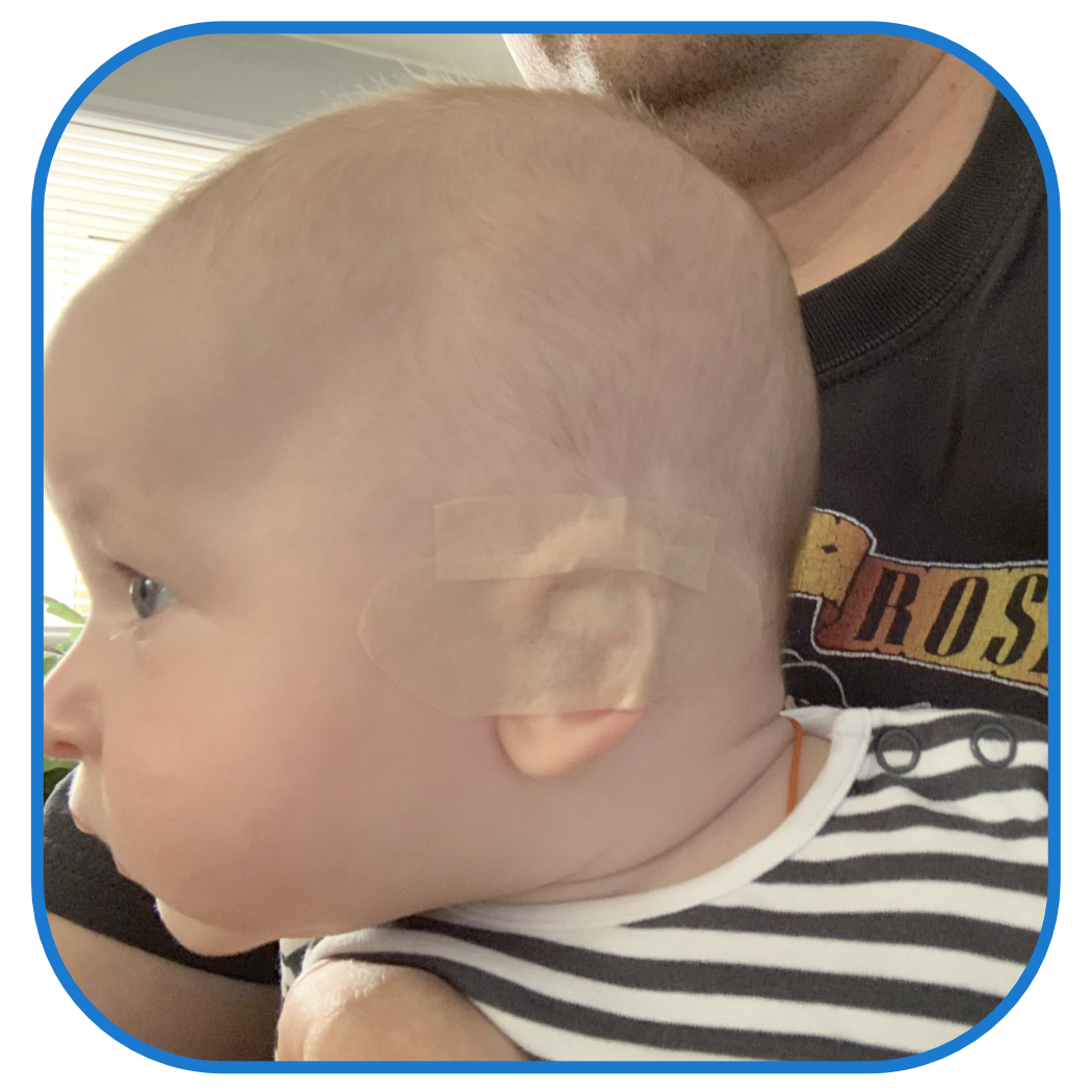 correcting a baby ear parent review | EarBuddies