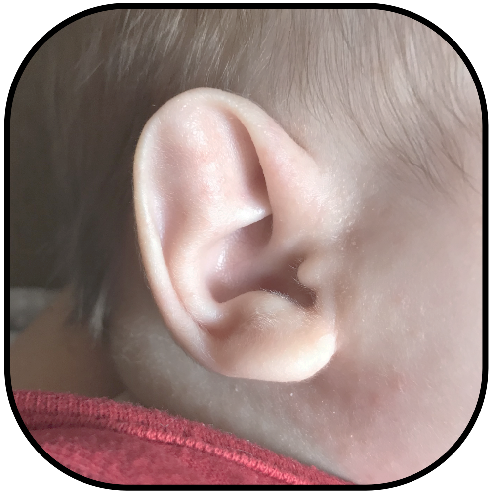 earbuddies stahls ear