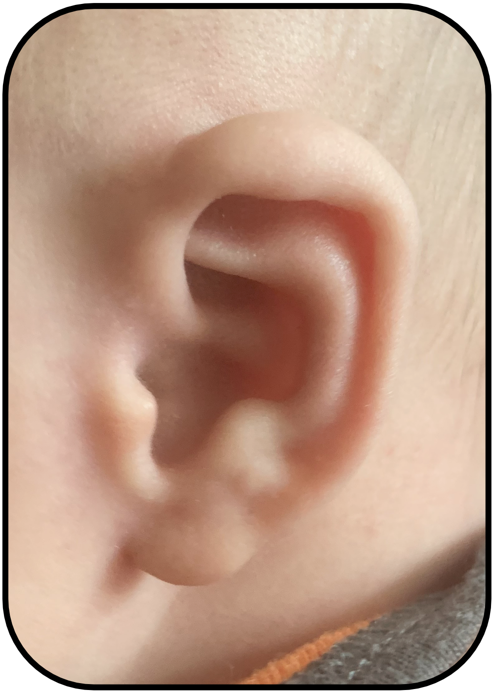 baby ear folds down