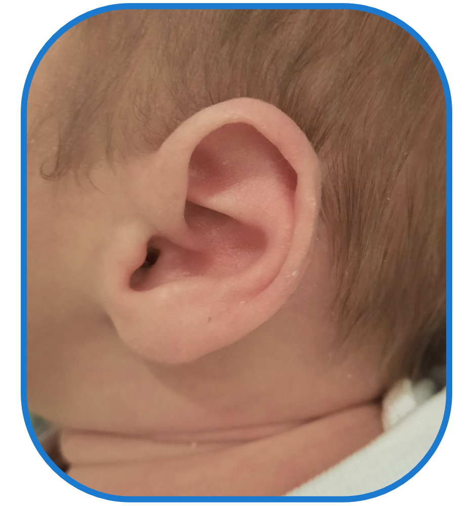 Baby using Ear Buddies
