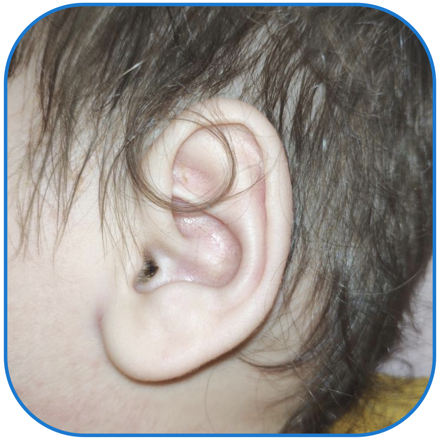 Ear Solution for Babies