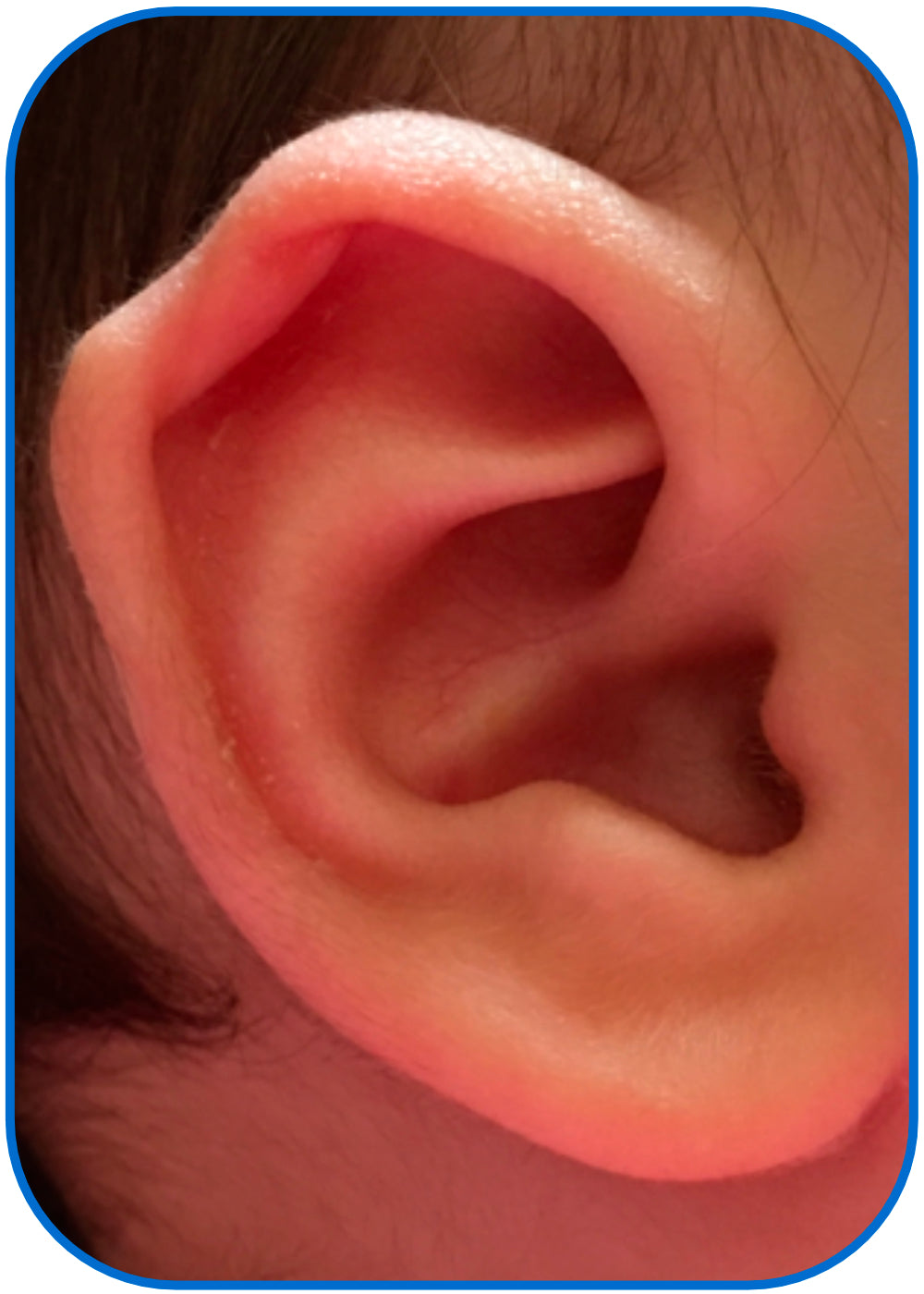 corrected ear in babies buddies parent review