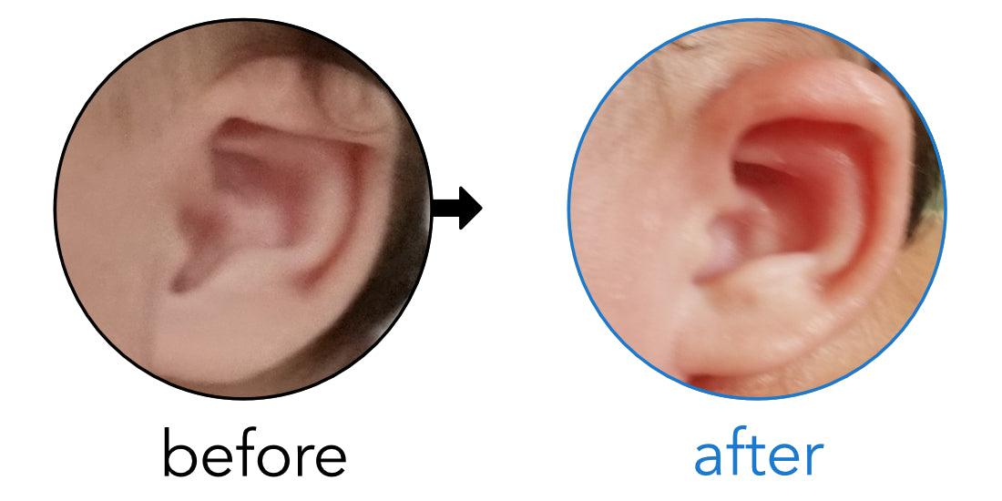 folding top of baby ear