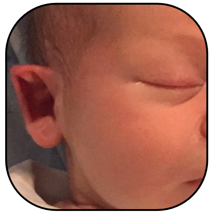 newborn baby with pointy out ears