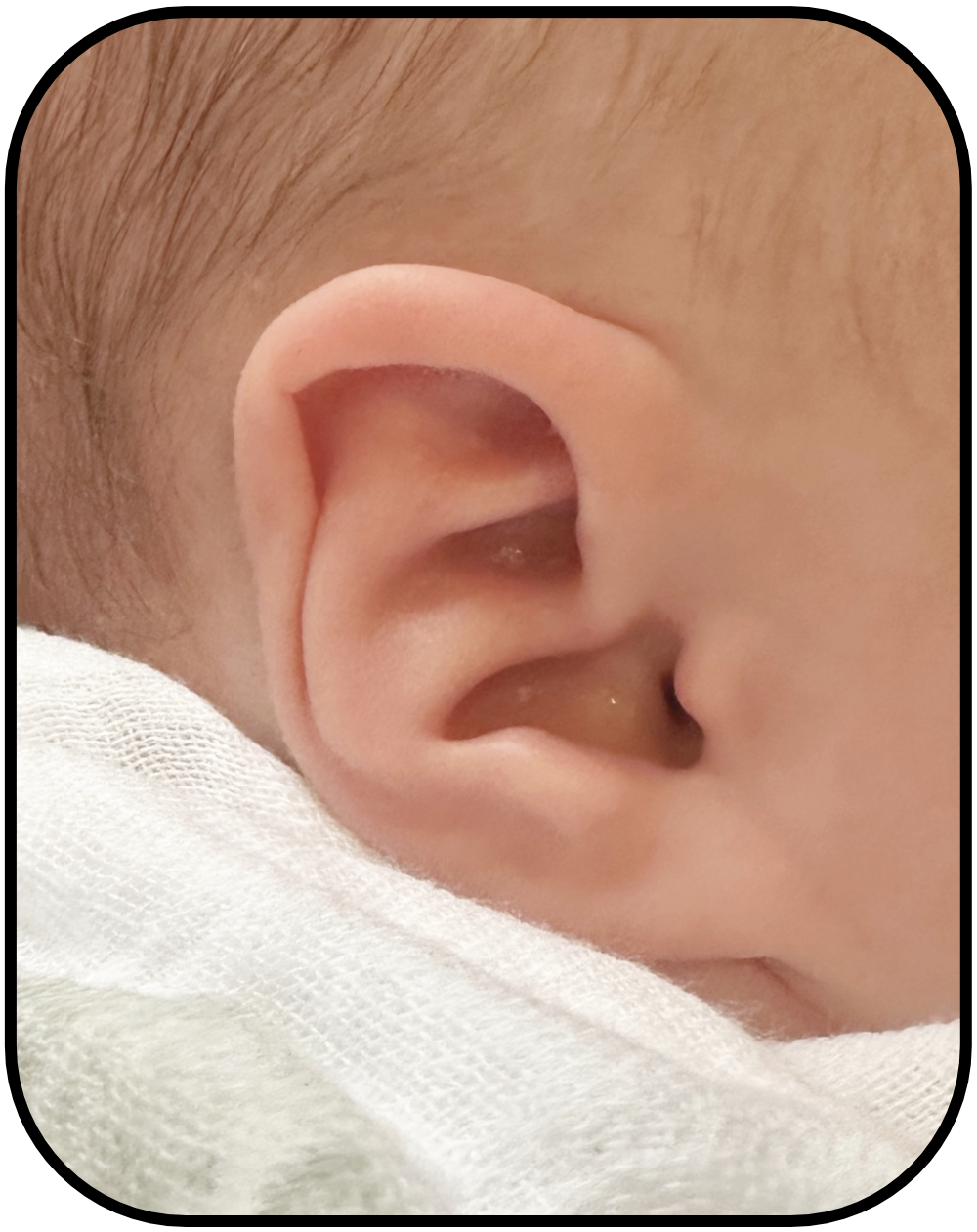 baby ear conchal crus