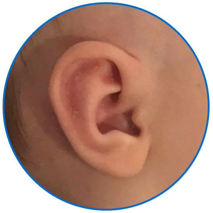 corrected stahl's bar ear baby ear buddies parent review california