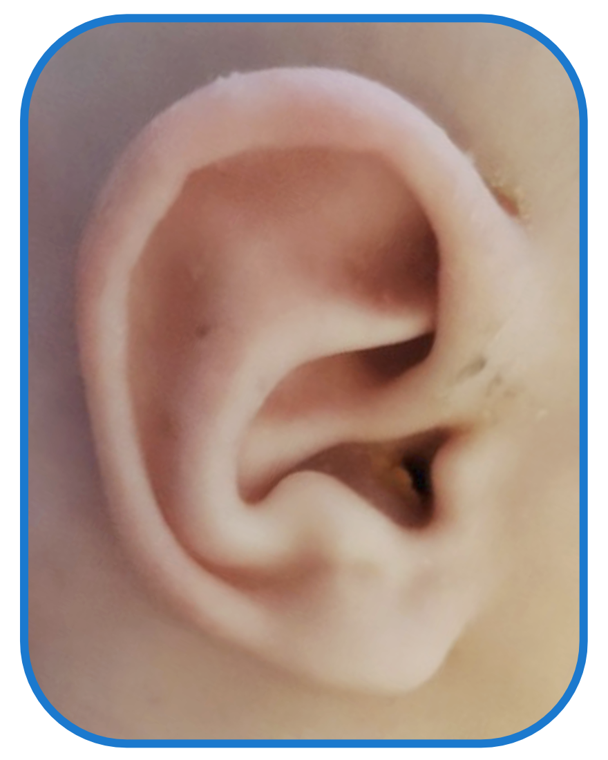baby ear after ear buddies