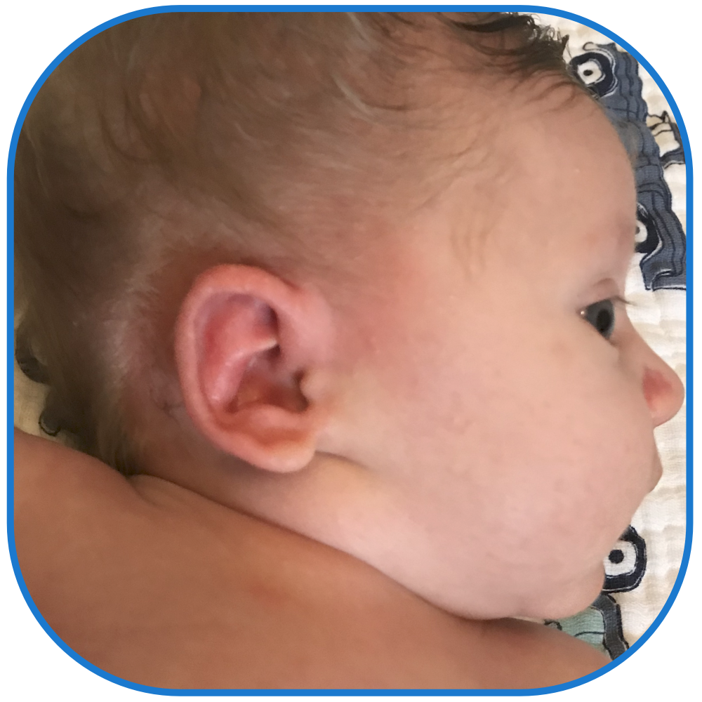 Baby ear review ear buddies