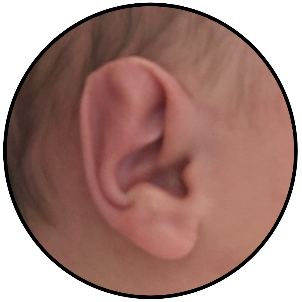 Baby Stahls Ear