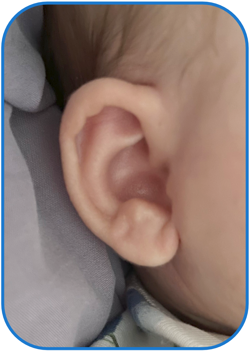 ear buddies results