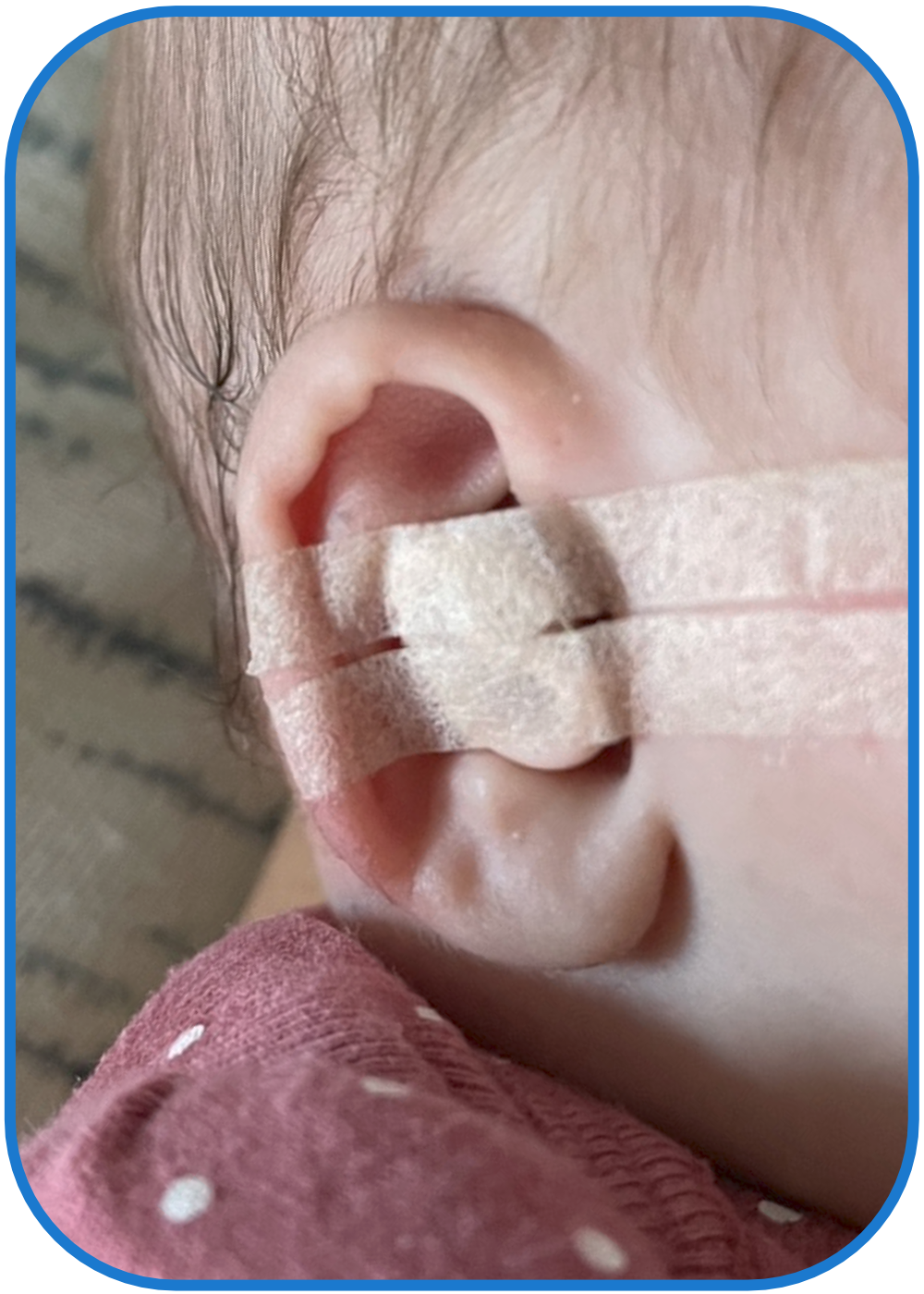 ear buddies fitted on baby