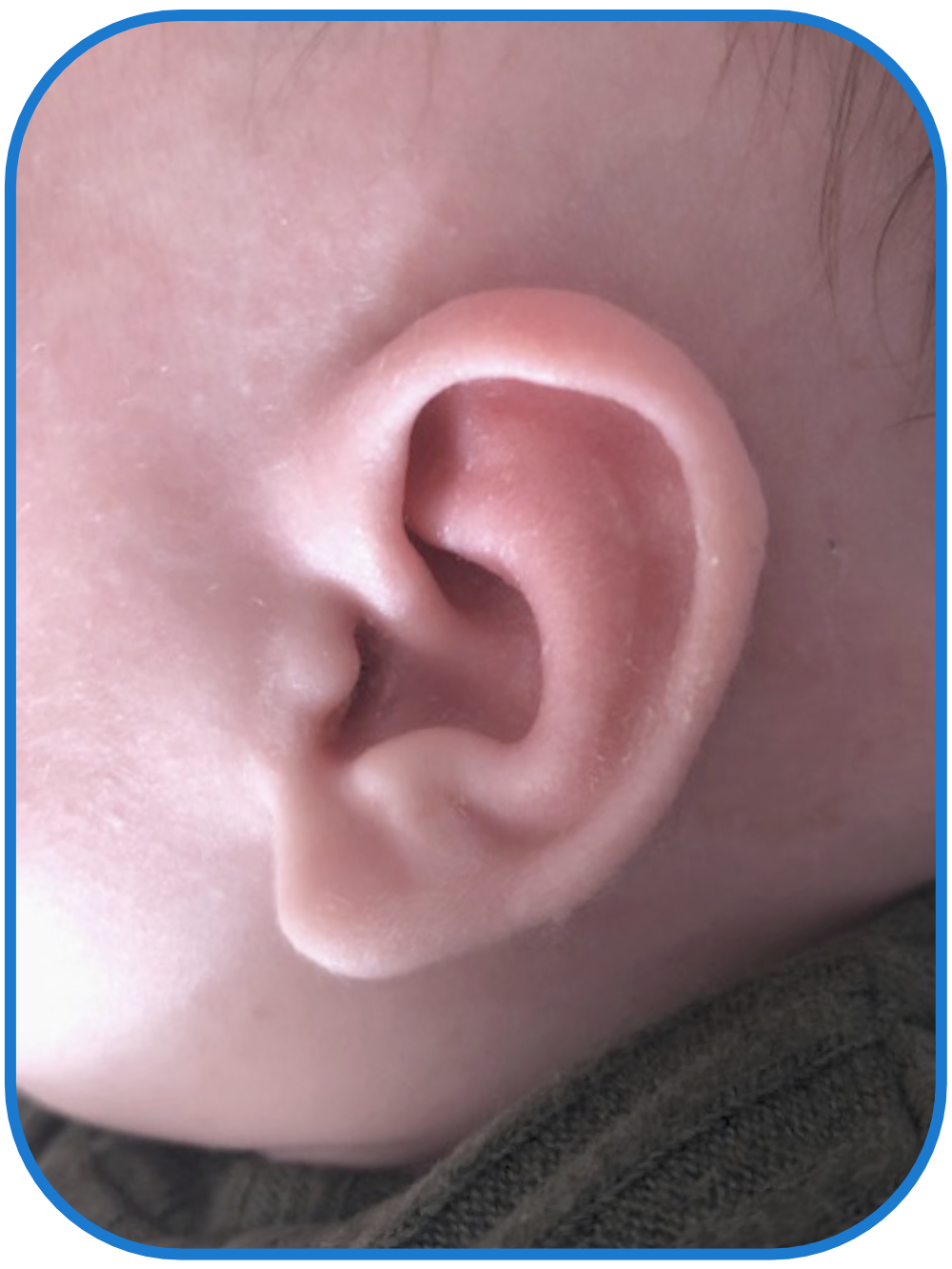 babies ear ear buddies