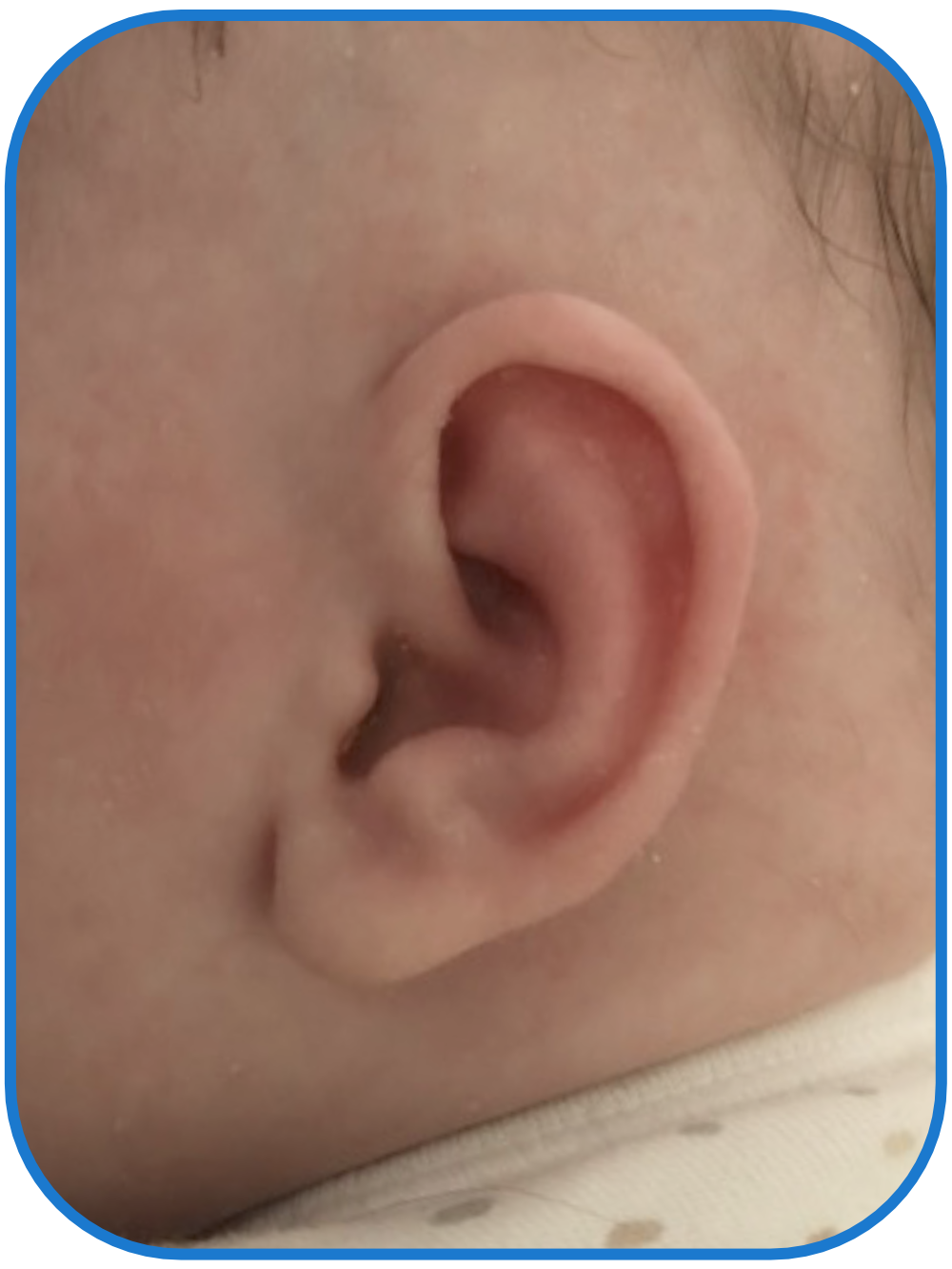 baby ear treatment