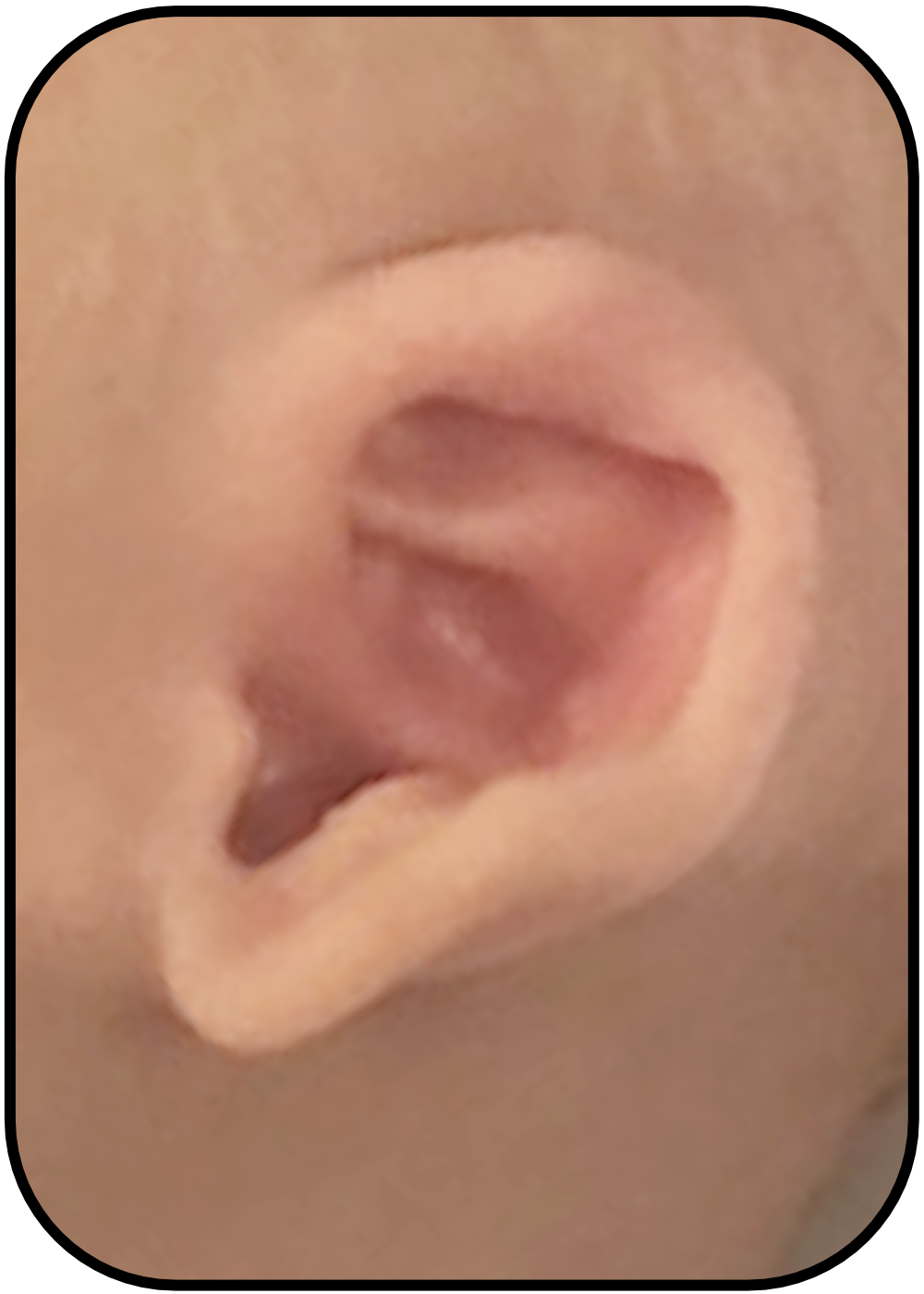 Baby Stahls Ear