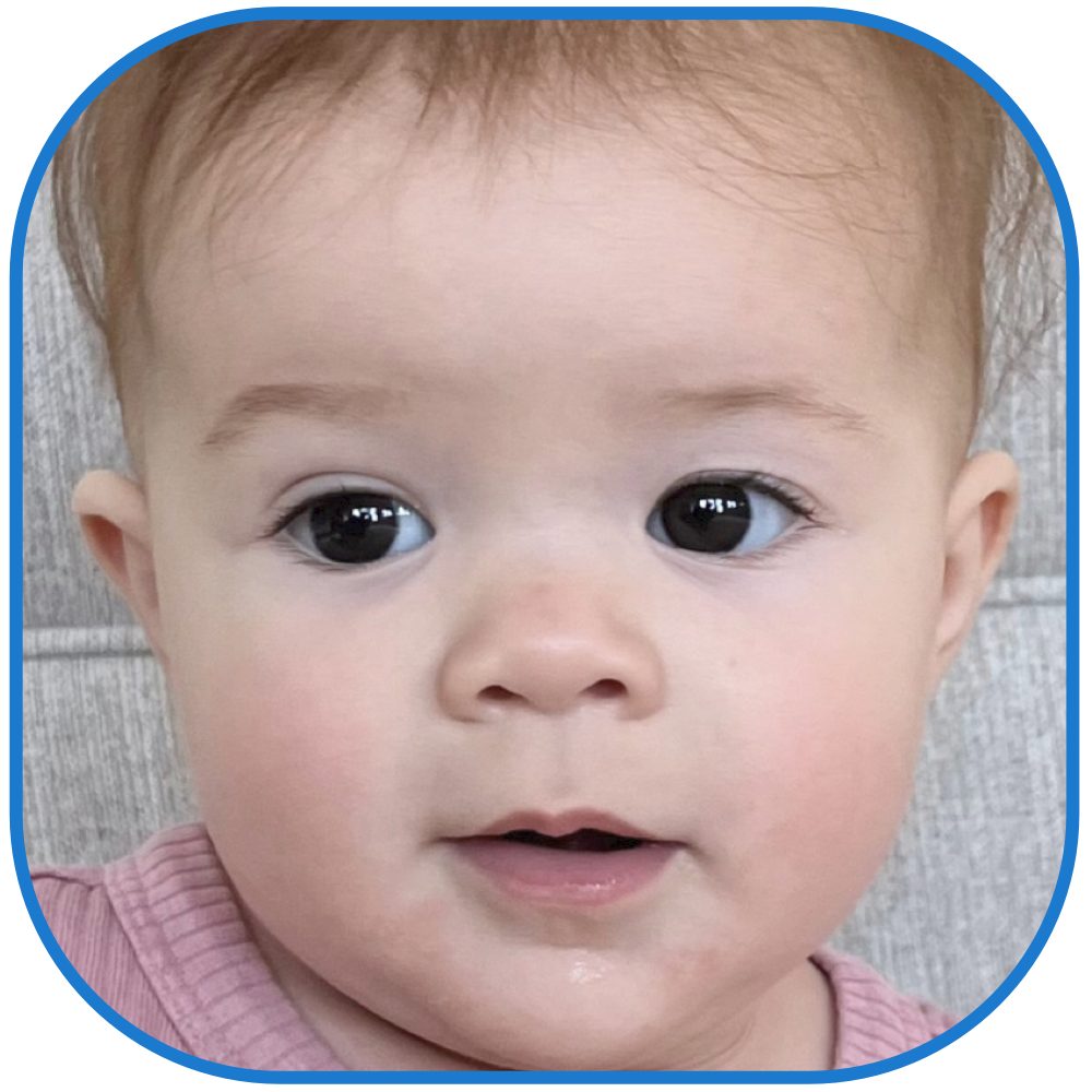 Otostick Baby Cosmetic correction Solves Big Ear Problem