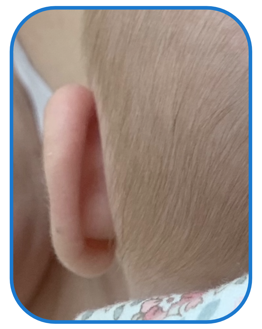 ear buddies results