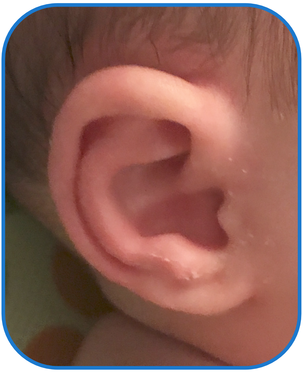 Baby Ear Review of EarBuddies