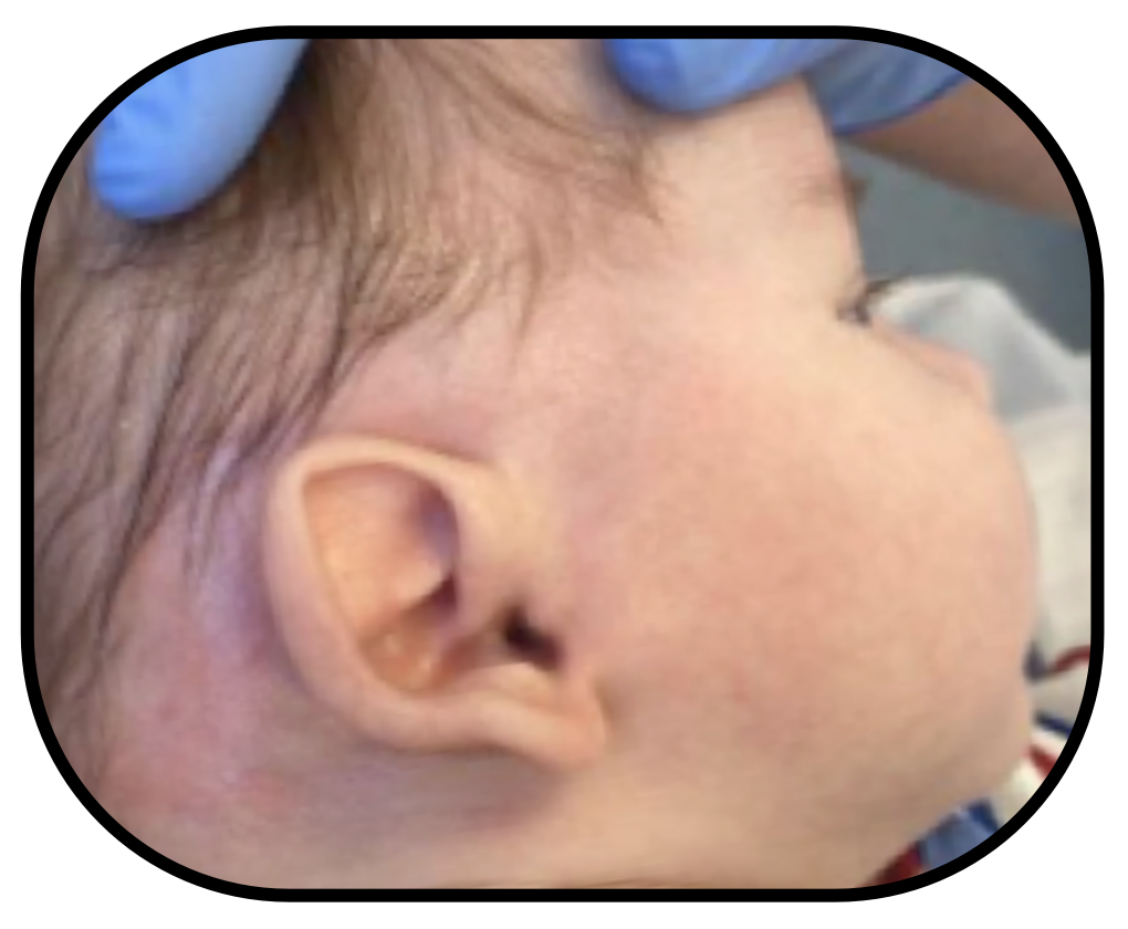baby ear earbuddies