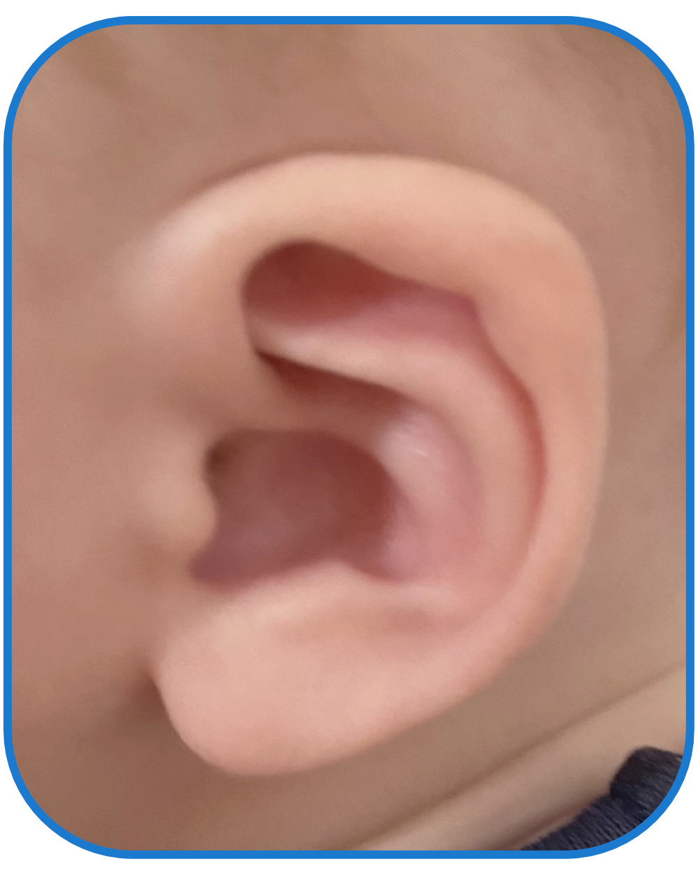ear buddies results