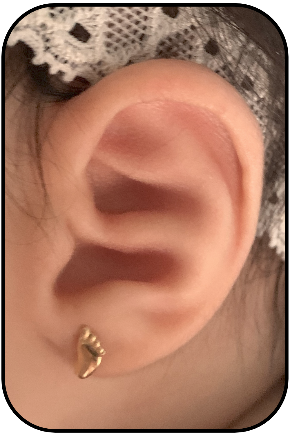 baby ear conchal crus