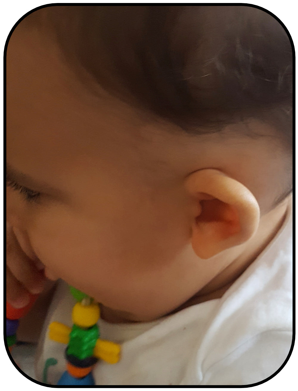 baby born with folded down ear