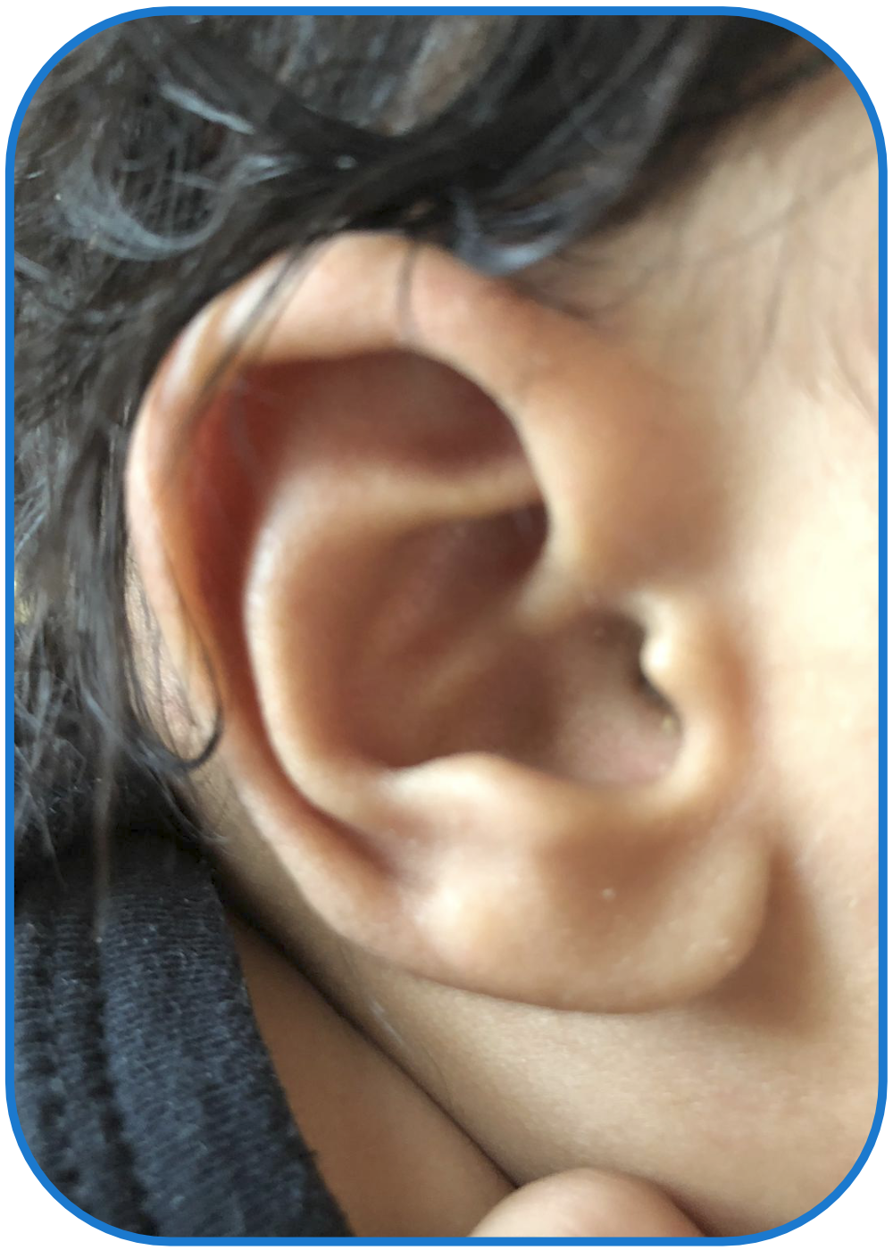 Ear Buddies Results