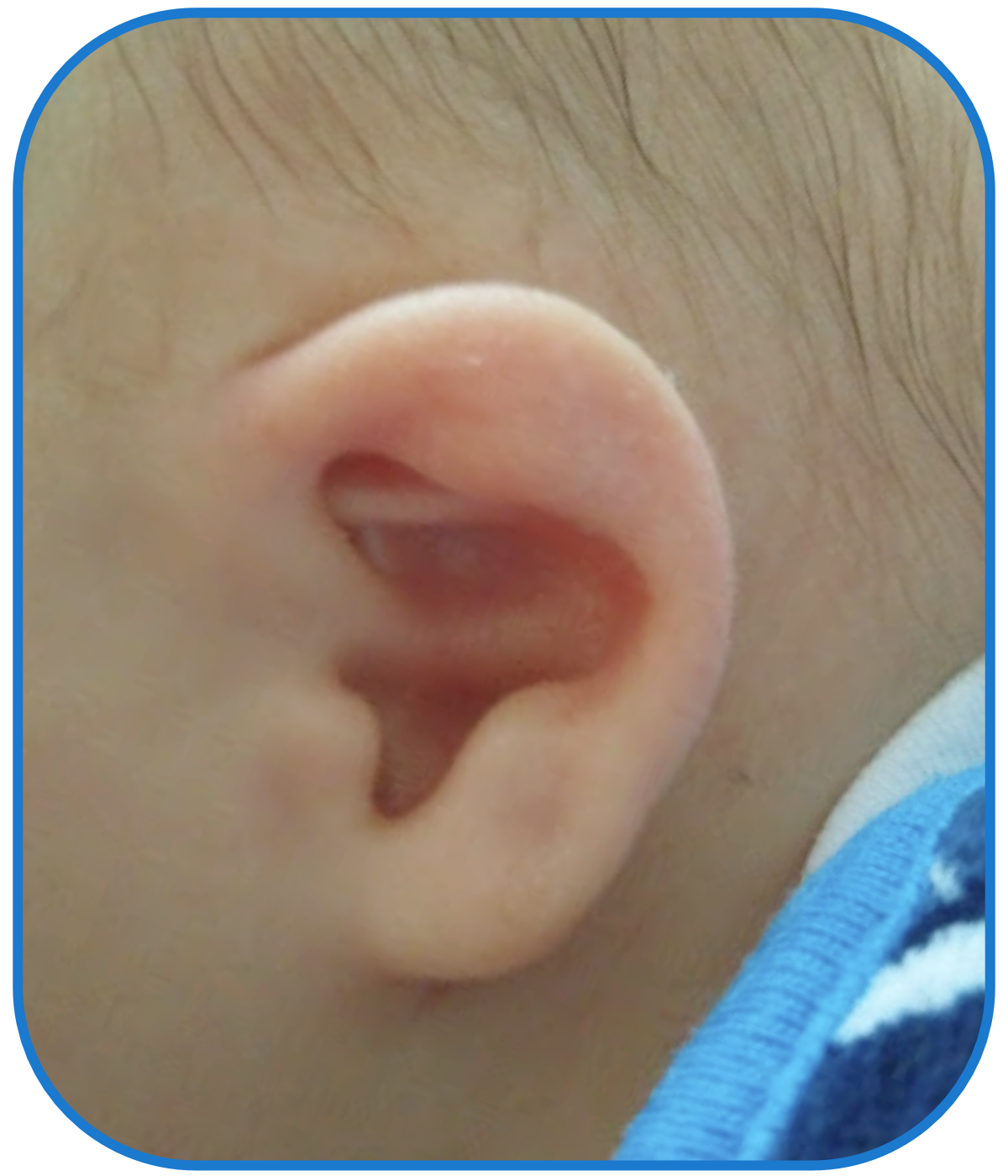 Ear Buddies Results