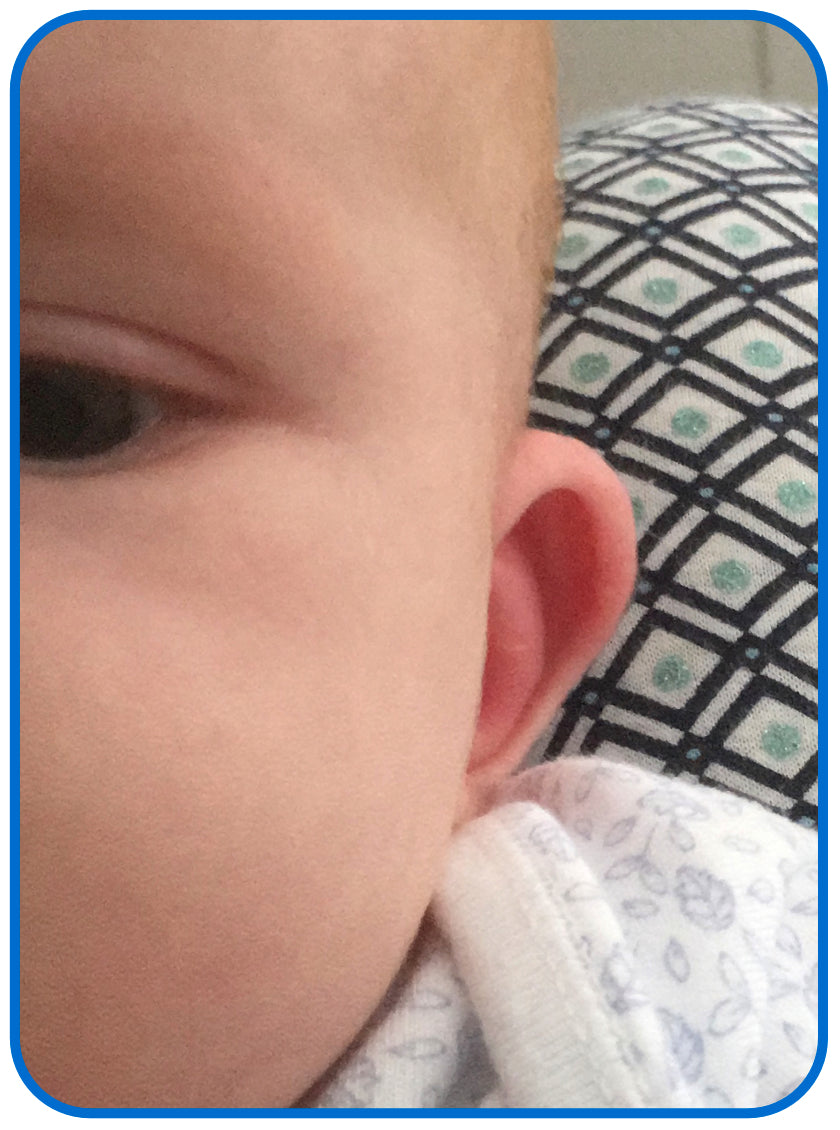 babies ear after ear buddies