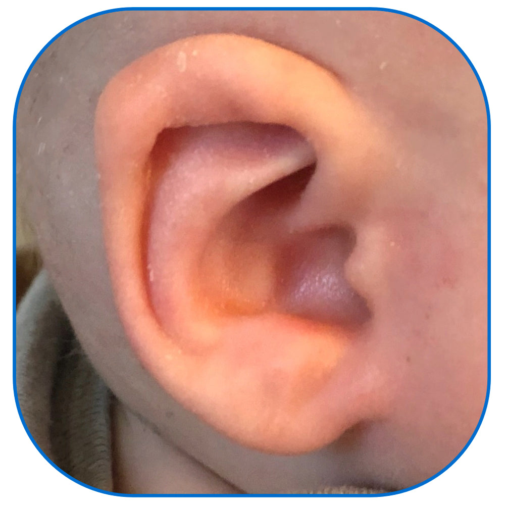 ear buddies parent conceal crus fitting