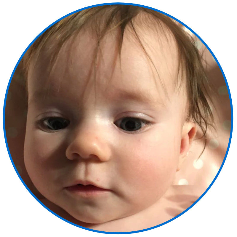 corrected stick out baby ear buddies parent review uk